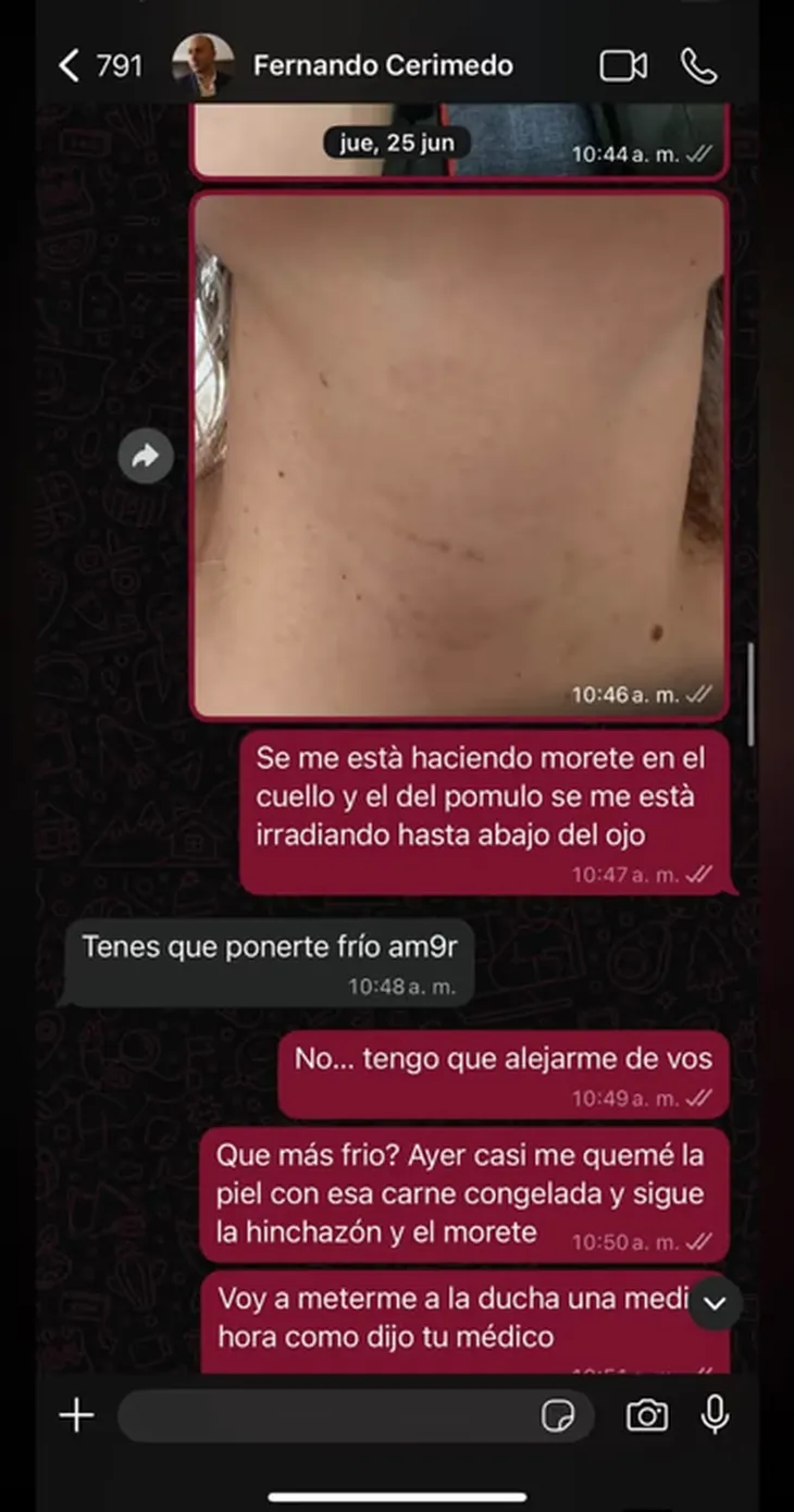Captura de chat donde Cerimedo reconoce haber agredido a Nadia Beller