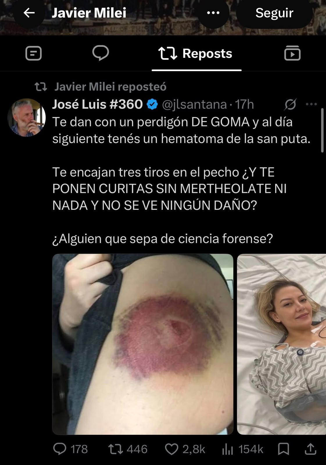 Javier Milei compartiendo dudas sobre las lesiones de Nadia Beller